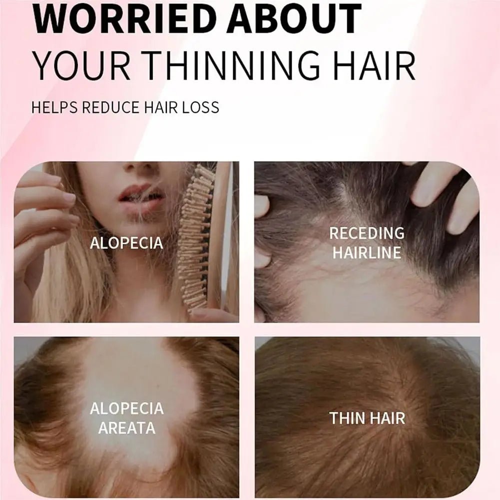 New Rosemary Fluffy Shampoo Gently Cleanses Hair, Naturally Fluffy, Moisturizing, Branching, Radiant And Smooth Shampoo - Newyla